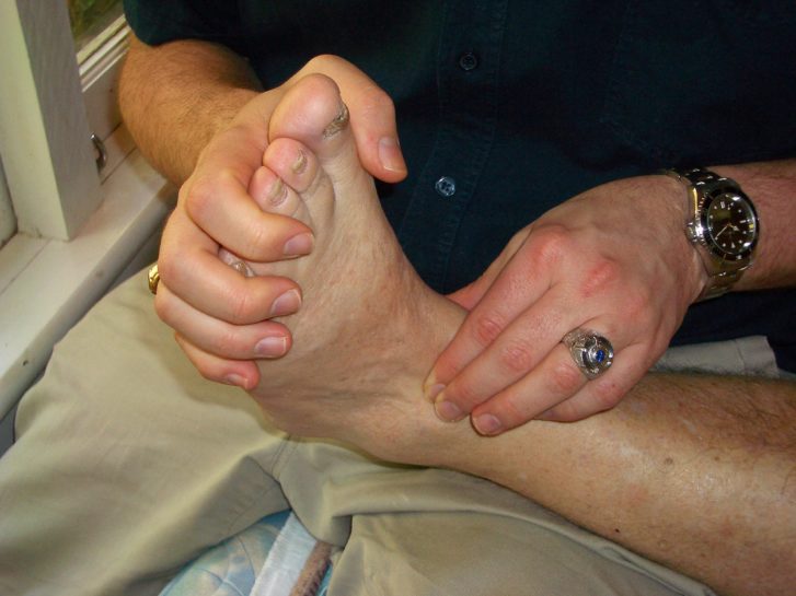 What is an Sprained Ankle? & What can Bowen Therapy do?